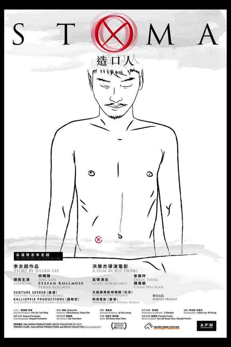 Stoma poster